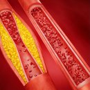 라이징PT 이미지