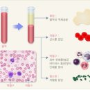 고름은 과연 더럽기만 한가? 이미지