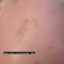 우리가축 인공수정 | 인공수정 1차 시작! 브레트라정, 폴리트롭 주사까지 직접 해본 후기