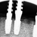 이편한치과기공소 이미지