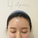 뷰티헤어라인 네이버블로그