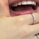 오페라치과의원 | 앞니 레진 후기🦷