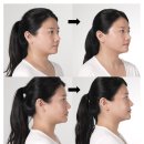 천천스크린 | 큰거 온다 메디큐브 : 업그레이드 된 하이포커스샷 플러스 한 달 사용 찐후기 𖤐𖤐𖤐