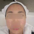 이피온드스킨