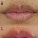 꽃물 | 꽃물틴트립(입술문신) 후기💋