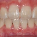 스마일100치과의원 이미지