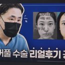 브랜든시티의원 | 창원성형외과에선 20분도 안 걸리는 수술? 남들과는 다르게! 쌍꺼풀 수술 리얼 후기