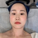 형곡중학교 | 구미 바르델에스테틱 구미크레이지015 인생 첫 고주파리프팅 후기