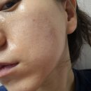 에이모드헤어(A:mode) | [후기/뷰티] EOA 풀쎄라 프로 내돈내산 (하이푸 디바이스 리프팅기기)