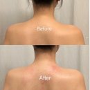 향기나는숲에스테틱향림 | [카리언뷰티클리닉] 서면 웨딩관리 드레스관리 예비신부필수관리 솔직후기