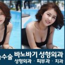 역삼바노바기성형외과 네이버블로그