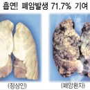 담배소송 진행하는 청렴도 최하위 공공기관, 건강보험공단 이미지