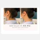 클래시 | 연산동왁싱 클래시뷰티 뒷목왁싱 후기｜승무원 관리, 예신 관리 추천