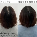 ▶마음에점을찍다 광주본점 SMP 두피 소개