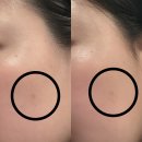 륀느로즈 | ✨줄기세포 유래 엑소좀 앰플 입고! 피부 본연의 힘을 깨우는 프리미엄 케어✨EXO-RSC 더륀느에서 만나세요