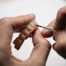 이백치과기공소 이미지