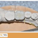 서초치과기공소 이미지