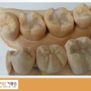 다이안치과기공소 이미지