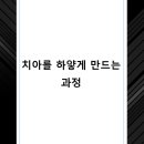 미소를만드는치과의원 네이버블로그