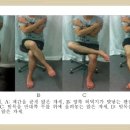 다리를 꼬고 앉는 자세를 오래하면 왜 오자형의 다리가 되는가? 이미지