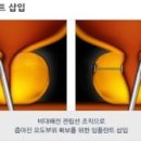 엠탑남성의원 이미지