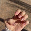 요온네일 이미지