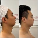 망포역 피부관리 라이트리프 수원영통점