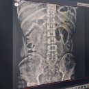 삼성본신경외과의원 네이버블로그