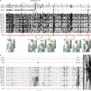 기면증 탈력발작 &#39;시상하부 오렉신 뉴런 장애&#39; 자가면역질환 ..2014 nature 이미지