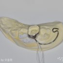 이소치과기공소 네이버블로그