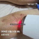 셀비아 | 7살 아들의 건조하고 예민한 피부 셀비아 미솔로지 앰플 & 베리어 카밍크림 사용 후기