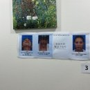 노즈랩의원 | 노즈랩 성형외과에서 기능코성형 상담 후기