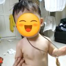영유아 검진, 횡격막 이상 발견