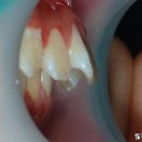 건강에 대한 고민 해결방법 | 아찔한 순간들을 건강하게, 치아와 턱 고민 솔직 후기!