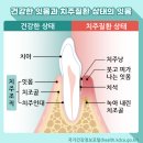 다짐치과의원 네이버블로그