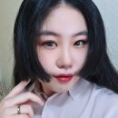 요셉약국 | 대구 요셉성형외과 쌍수 재수술 후기