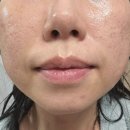 자르자르 | 멜라토닝 케어 시작, 유니자르 미백앰플 솔직후기