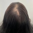 구미 가르마 탈모커버 잘하는 곳 더블라인스칼프 후기 탈모관리와 수강까지 가능한 곳