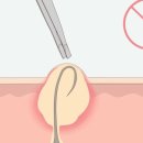 아일왁싱 이미지