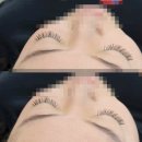 명지속눈썹연장 추천 플랫모 C컬 조합 인생속눈썹 올킬 후기