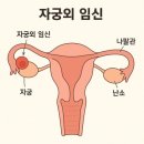 가성 이미지