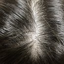 강남라렌의원 이미지