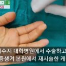 케이스대학