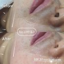 하이토탈뷰티 이미지