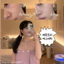 레몬트리 | 찐친이 추천해준 남천동 피부관리 레몬트리 모공제로 후기