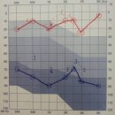 스타키보청기강남센터 이미지