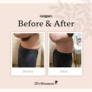 정화 | 정관에스테틱 미라클뷰티 | 복부정화 관리 후기, 부산윤곽관리·부산에스테틱 추천