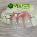 허브치과기공소 티스토리