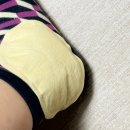4월(16~18) 다리 반깁스하고 목에 담까지 온 사람 처음 보세요?