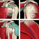 회전근어깨파열치료::관절내시경 봉합술! / 연세사랑병원 관절내시경센터 이미지